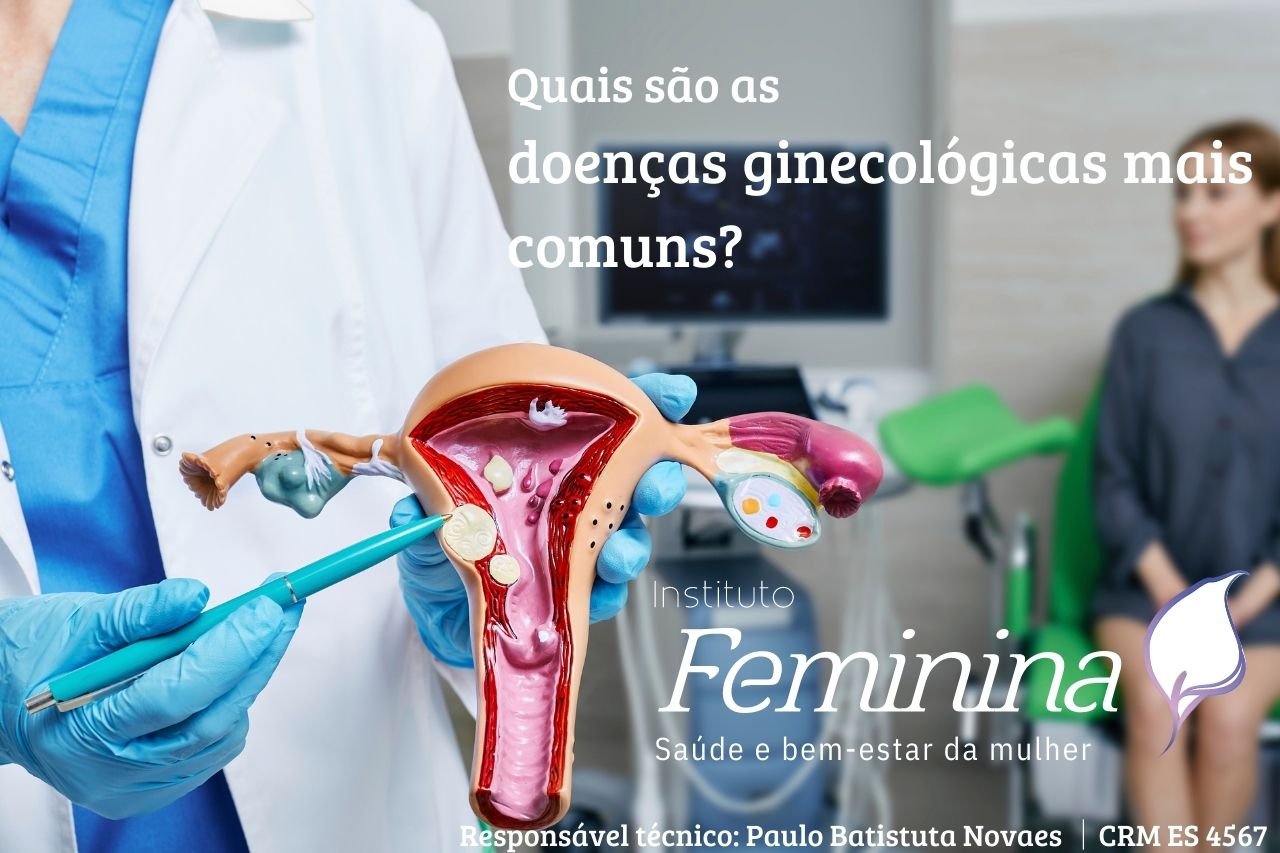 Neste artigo, discutiremos as doenças ginecológicas mais comuns